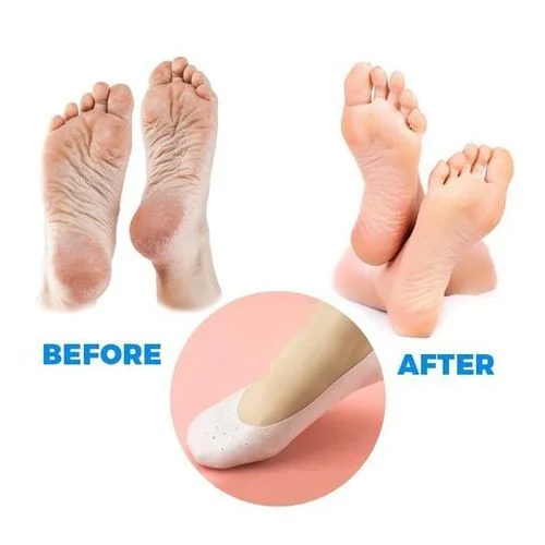 Pack Chaussette + Coussin Orthopédique + Chaussette a talon – en gel silicone – Pour Protection des Pieds – Image 4